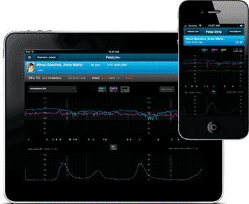 Image: The Cerner FetaLink+ solution (Photo courtesy of Cerner).